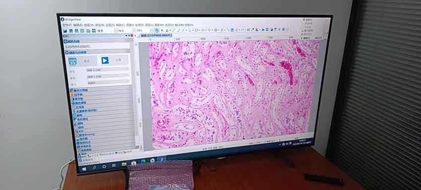 南京東南司法鑒定所法醫(yī)鑒定采用4K超高清病理圖像多人共攬會檢系統(tǒng)